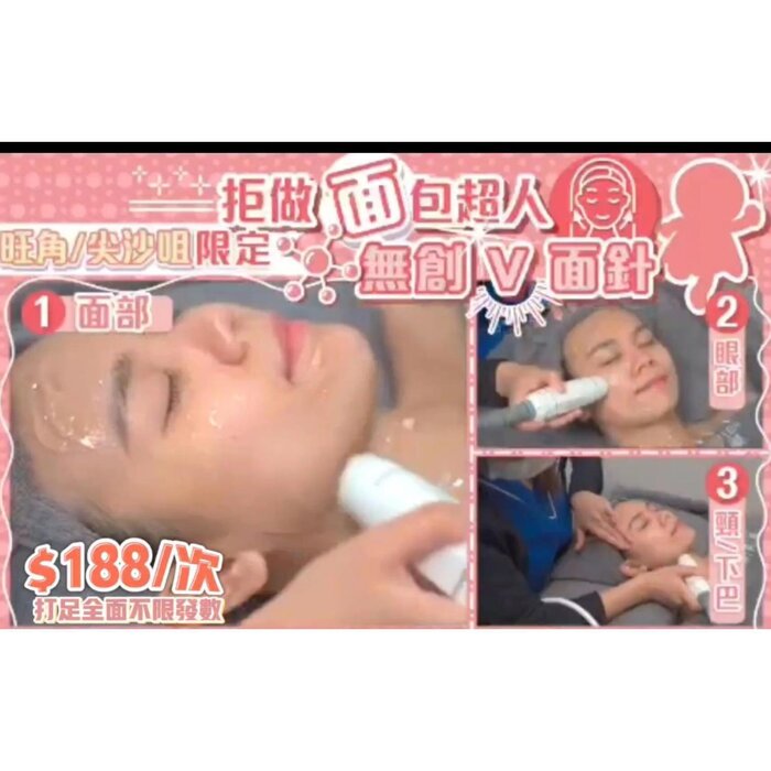Skin Perfect Center 無創V面針 x10次 Fixed SizeProduct Thumbnail