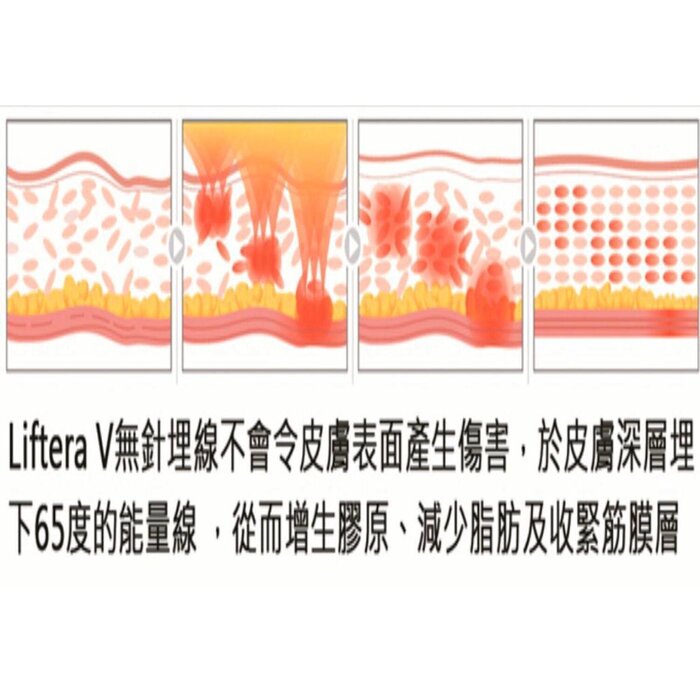 Perfect Healthy Beauty Ultra Thread Lifting Treatment Fixed SizeProduct Thumbnail
