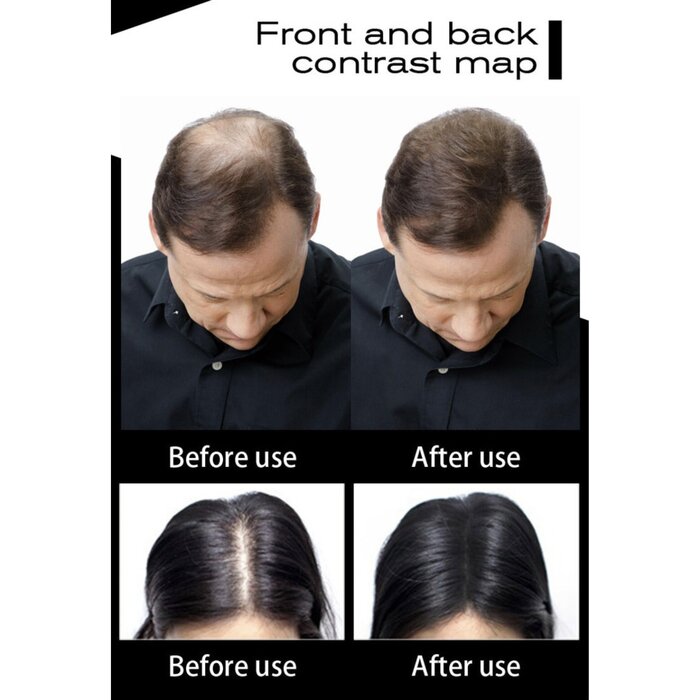 HAIROOM Hair Volumn Fibers (Black) 25g  Product Thumbnail